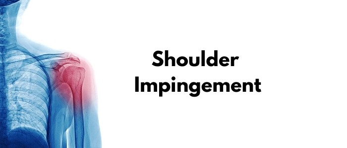 shoulder impingement, What is shoulder impingement? , shoulder pain