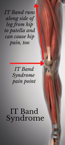 IT band syndrome